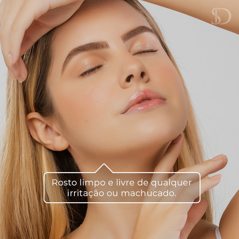 Epilação facial com linhas