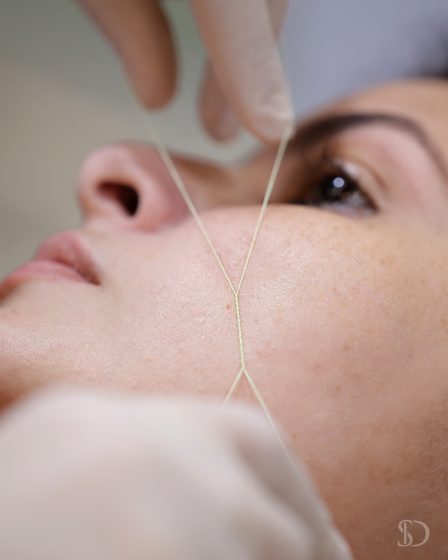 Epilação facial com linhas